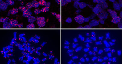 Células humanas con telómeros largos (izq.) y con telómeros cortos (dcha.). CNIO